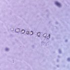 DiatomeProbablementChaetoceros2_aa22_23_46_221153.jpg